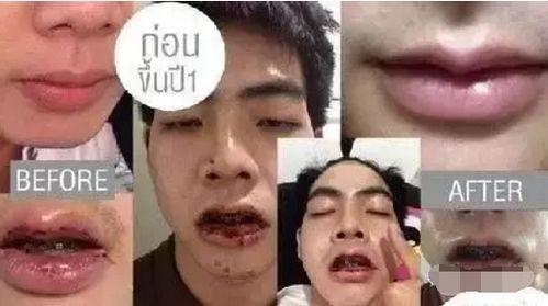 整容男网红吃瓜事件